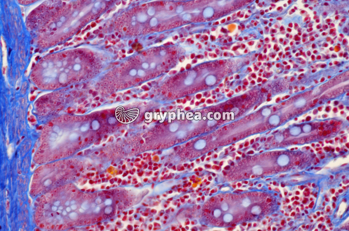 Duodenum x100 - gryphea.org